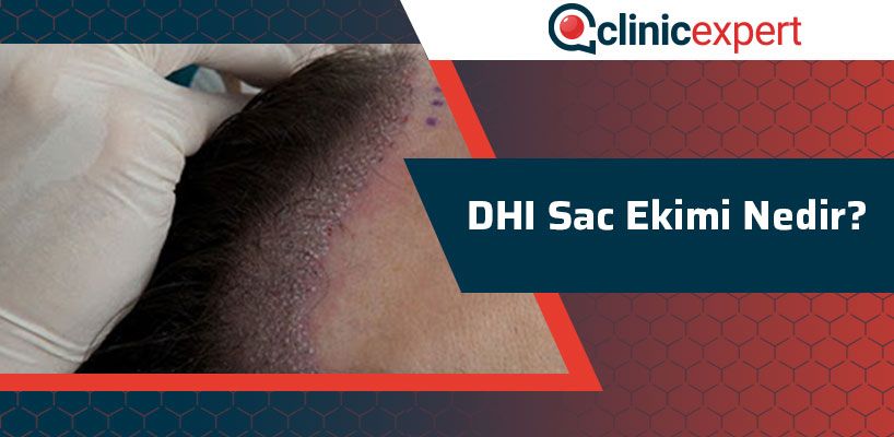 dhi-sac-ekimi-nedir-cln