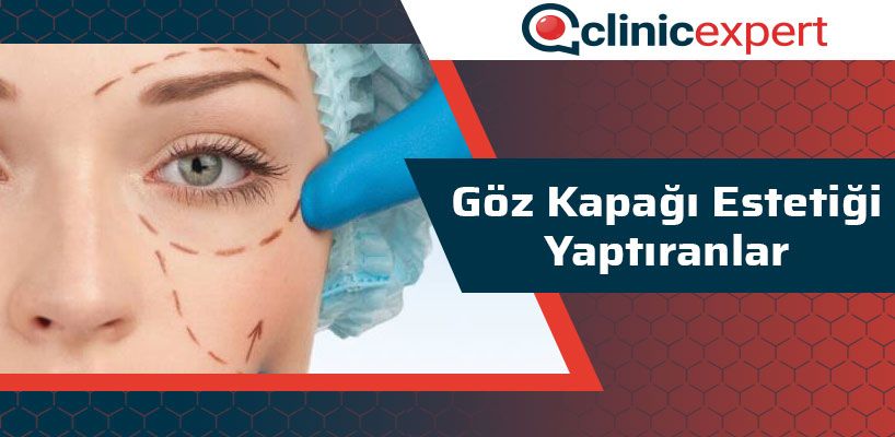 goz-kapagi-estetigi-yaptiranlar-cln