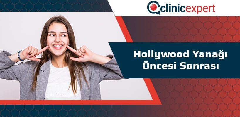 hollywood-yanagi-oncesi-sonrasi-cln-min