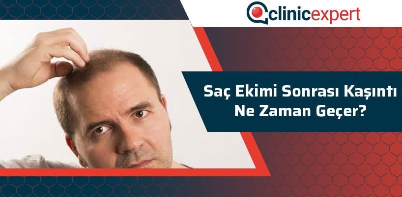 sac-ekimi-sonrasi-kasinti-ne-zaman-gecer-cln-min