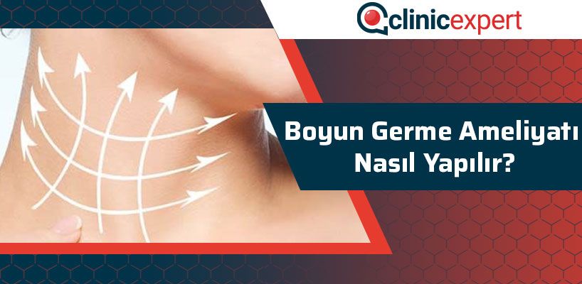 Boyun Germe Ameliyatı Nasıl Yapılır?