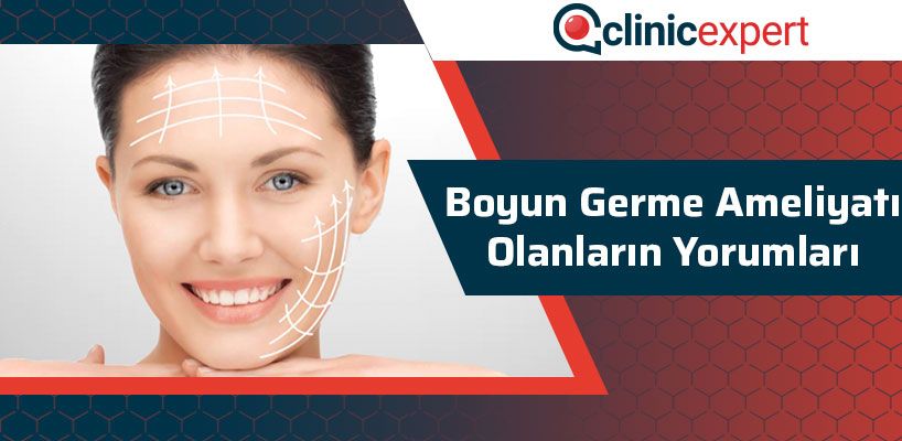 Boyun Germe Ameliyatı Olanların Yorumları