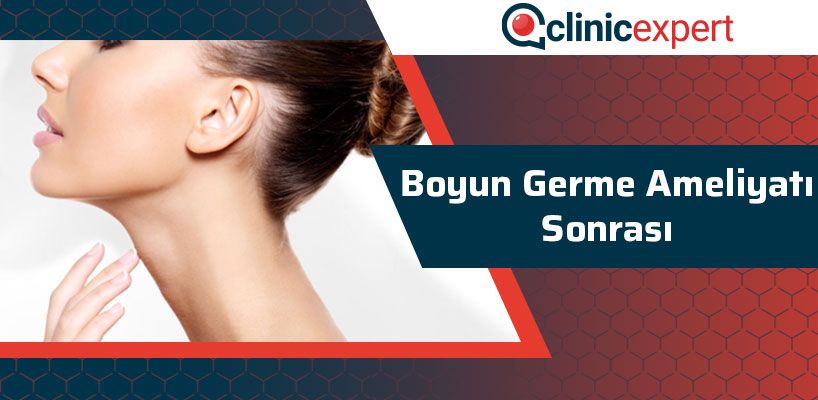 Boyun Germe Ameliyatı Sonrası