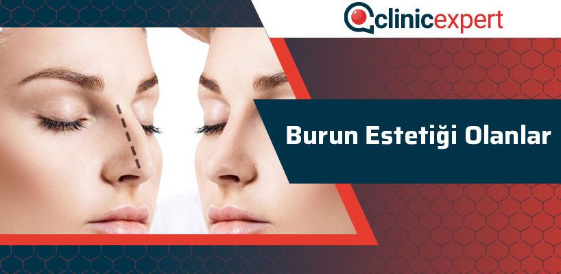 burun-estetigi-olanlar-cln