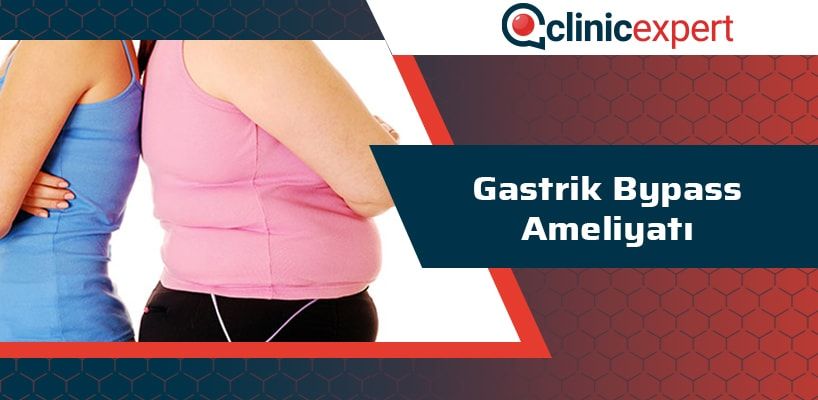 Gastrik Bypass Ameliyatı