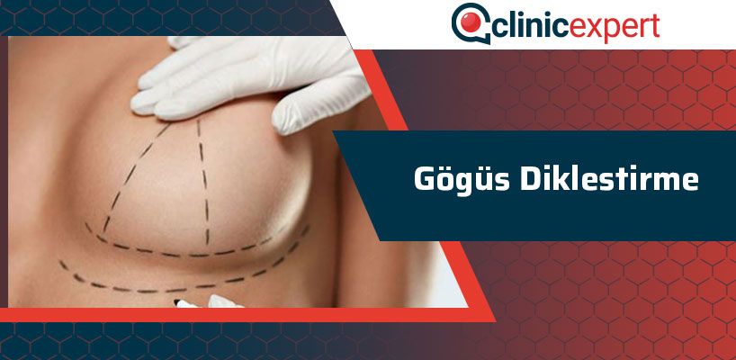 gogus-diklestirme-cln