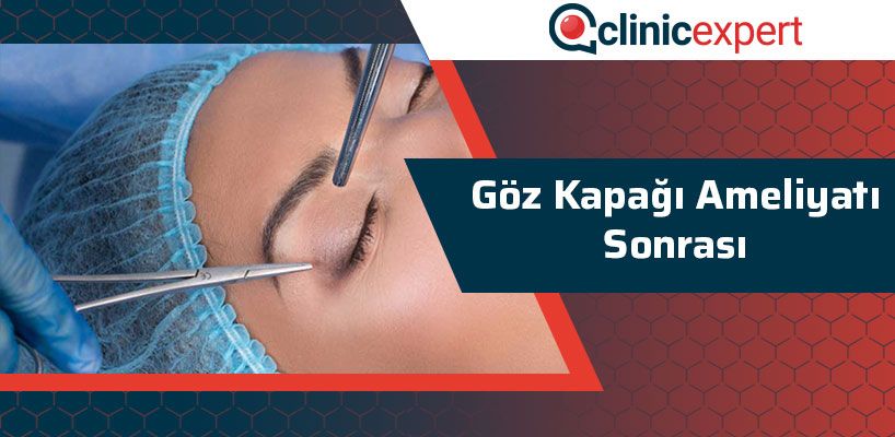 goz-kapagi-ameliyati-sonrasi-cln