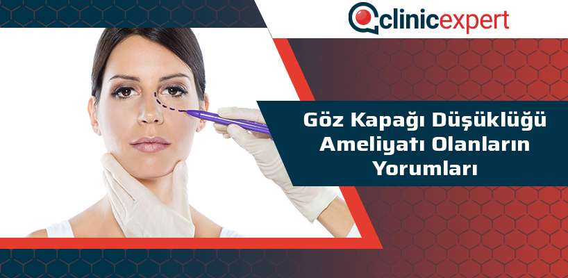 goz-kapagi-dusuklugu-ameliyatıi-olanlarin-yorumlari-cln