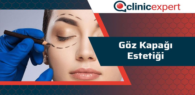 Göz Kapağı Estetiği Nedir