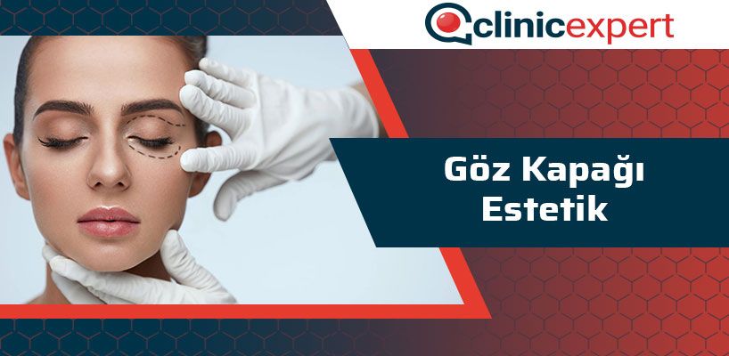 Göz Kapağı Estetik