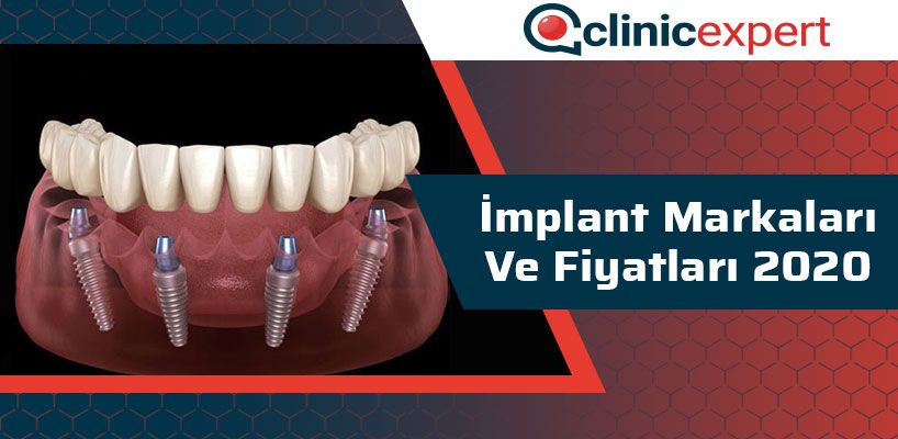 İmplant Markaları ve Fiyatları 2020