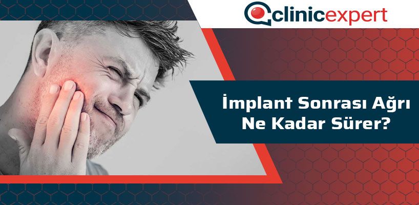 İmplant Sonrası Ağrı Ne Kadar Sürer