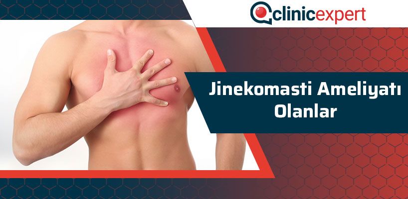 jinekomasti-ameliyati-olanlar-cln