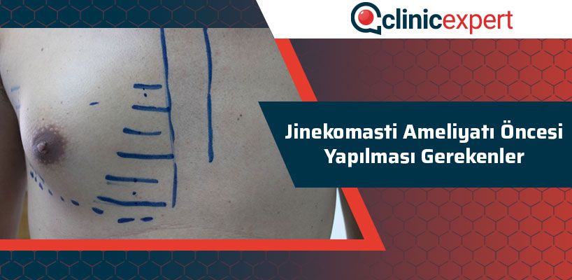 Jinekomasti Ameliyatı Öncesi Yapılması Gerekenler