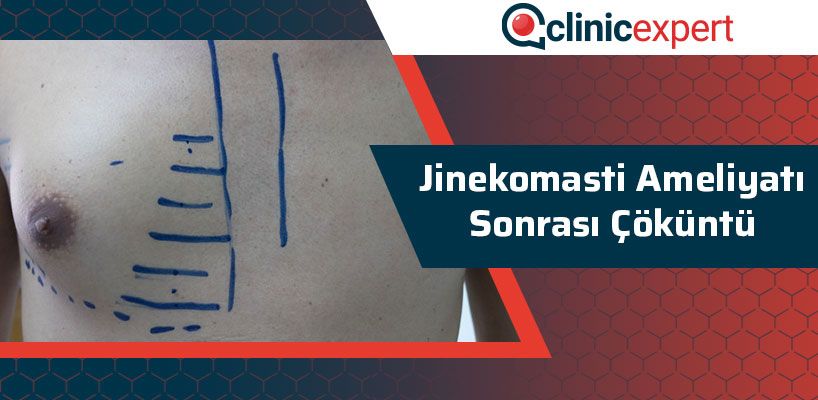 jinekomasti-ameliyati-sonrasi-cokuntu-cln