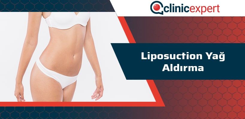 liposuction-yag-aldirma-cln-min