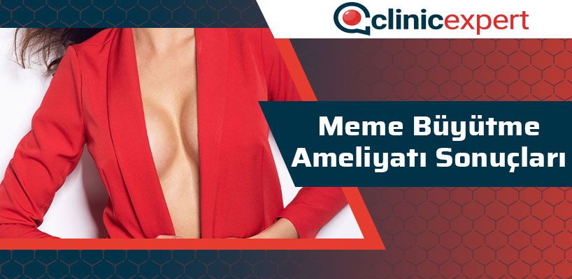 meme-buyutme-ameliyati-sonuclari-cln