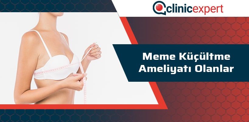 meme-kucultme-ameliyati-olanlar-cln-min