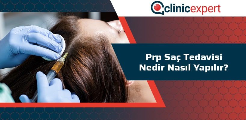 prp-sac-tedavisi-nedir-nasil-yapilir-cln-min