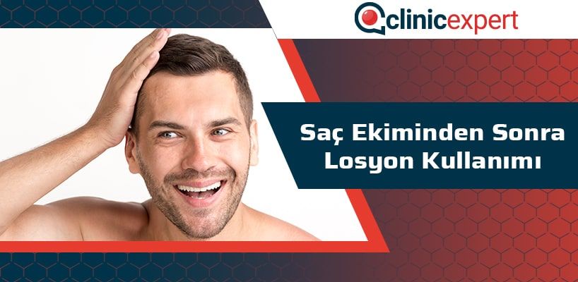 Saç Ekiminden Sonra Losyon Kullanımı