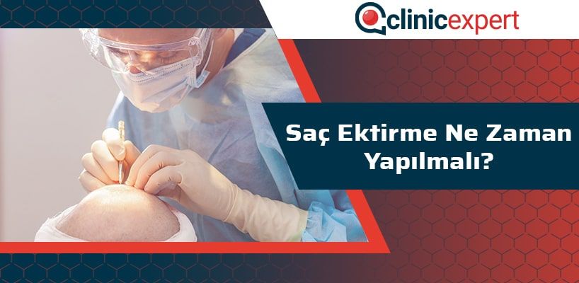 Saç Ektirme Ne Zaman Yapılmalı