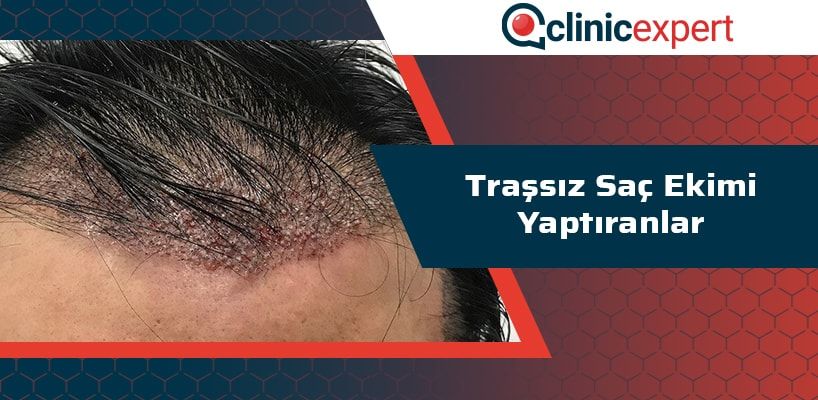 trassiz-sac-ekimi-yaptiranlar-cln-min