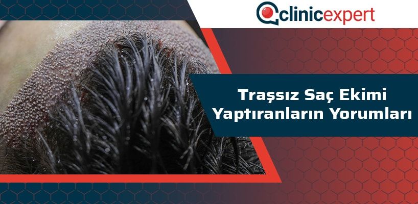 trassiz-sac-ekimi-yaptiranlarin-yorumlari-cln-min