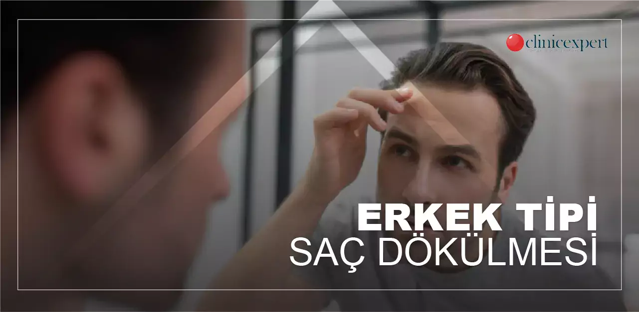 erkeklerde saç dökülmesi