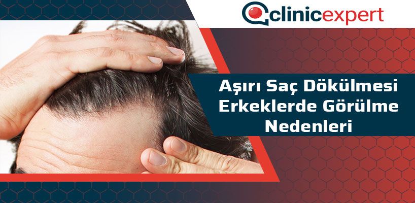 Aşırı Saç Dökülmesi Erkeklerde Görülme Nedenleri