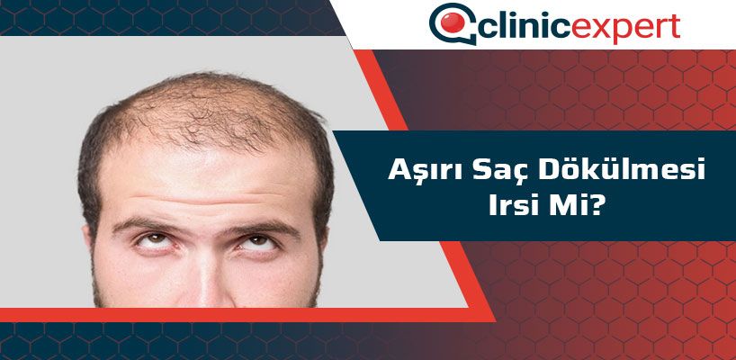 Aşırı Saç Dökülmesi İrsi Mi?