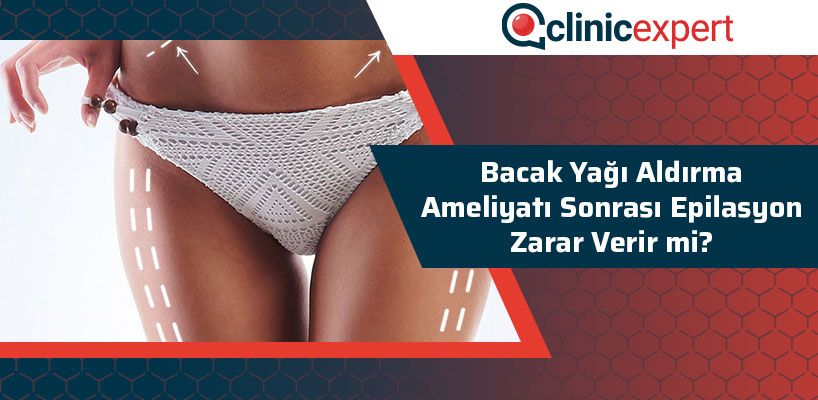 Bacak Yağı Aldırma Ameliyatı Sonrası Epilasyon Zarar Verir Mi? 