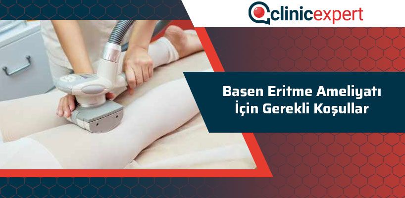 Basen Eritme Ameliyatı İçin Gerekli Koşullar