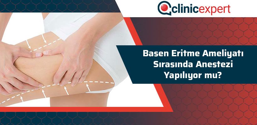 Basen Eritme Ameliyatı Sırasında Anestezi Yapılıyor Mu?