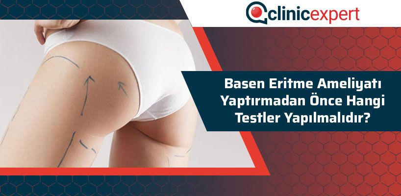 Basen Eritme Ameliyatı Yaptırmadan Önce Hangi Testler Yapılmalıdır?