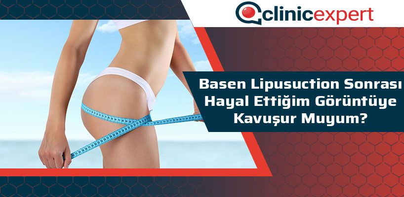 basen-lipusuction-sonrasi-hayal-ettigim-goruntuye-kavusur-muyum-cln