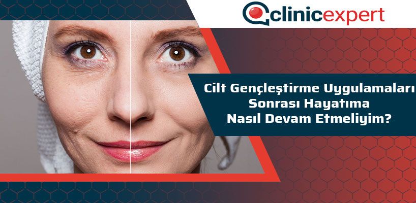 Cilt Gençleştirme Uygulamaları Sonrası Hayatıma Nasıl Devam Etmeliyim?