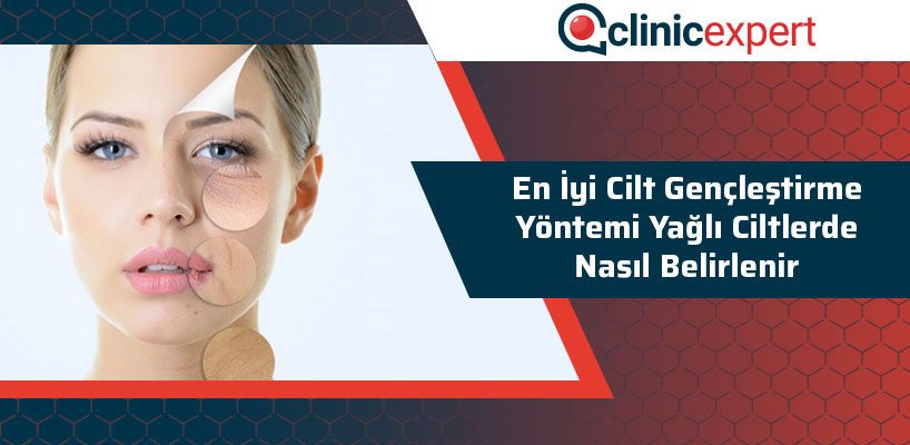 En İyi Cilt Gençleştirme Yöntemi Yağlı Ciltlerde Nasıl Belirlenir