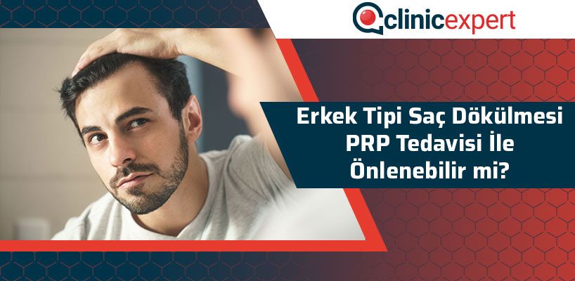 erkek-tipi-sac-dokulmesi-prp-tedavisi-ile-onlenebilir-mi-cln