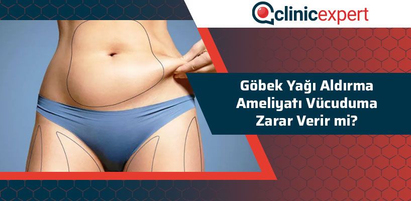 Göbek Yağı Aldırma Ameliyatı Vücuduma Zarar Verir Mi?