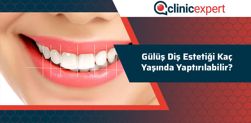 Gülüş Diş Estetiği Kaç Yaşında Yaptırılabilir?