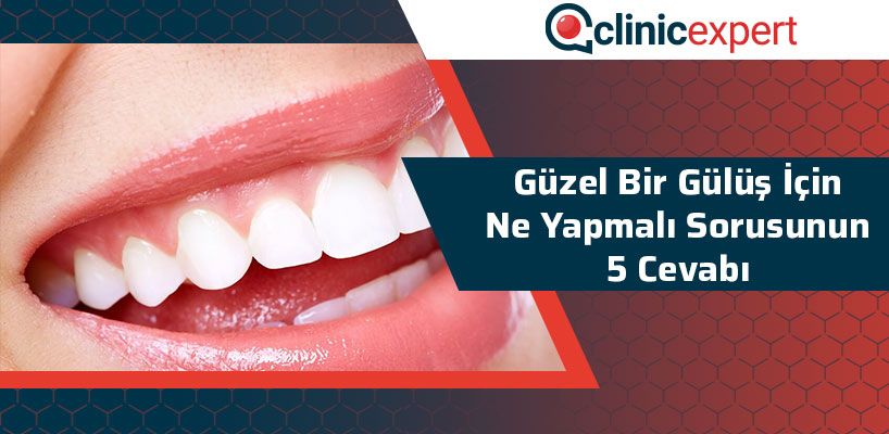 Güzel Bir Gülüş İçin Ne Yapmalı Sorusunun 5 Cevabı