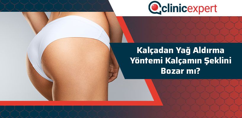 Kalçadan Yağ Aldırma Yöntemi Kalçamın Şeklini Bozar Mı?