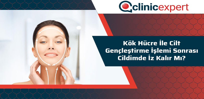 Kök Hücre ile Cilt Gençleştirme İşlemi Sonrası Cildimde İz Kalır Mı?