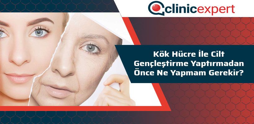 Kök Hücre ile Cilt Gençleştirme İşlemini Yaptırmadan Önce Ne Yapmam Gerekir?