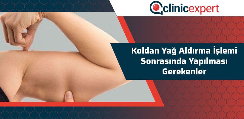 Koldan Yağ Aldırma İşlemi Sonrasında Yapılması Gerekenler