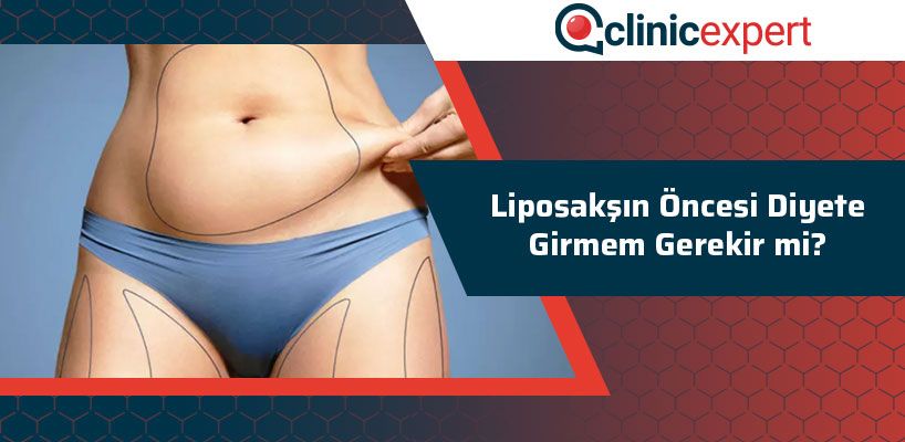 Liposakşın Öncesi Diyete Girmem Gerekir Mi?