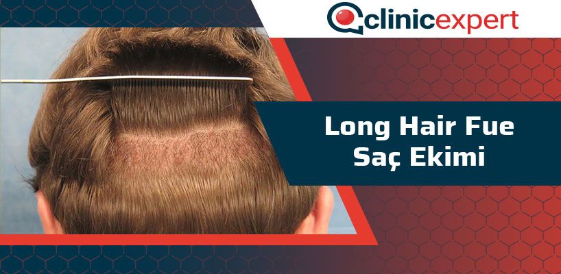 long-hair-fue-sac-ekimi-cln