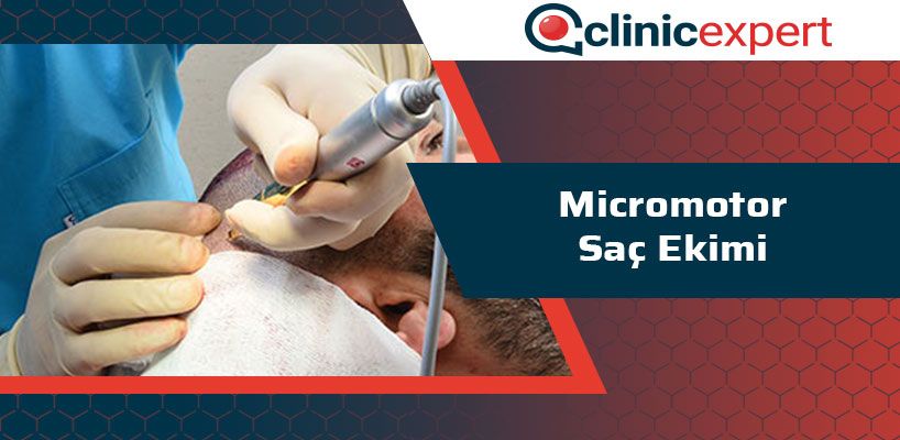 micromotor-sac-ekimi-cln