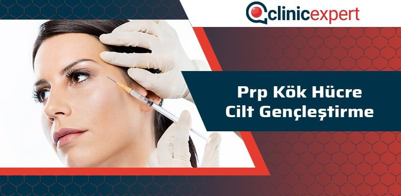 prp-kok-hucre-cilt-genclestirme-cln-min