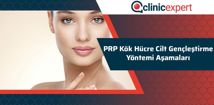 prp-kok-hucre-cilt-genclestirme-yontemi-asamalari-cln